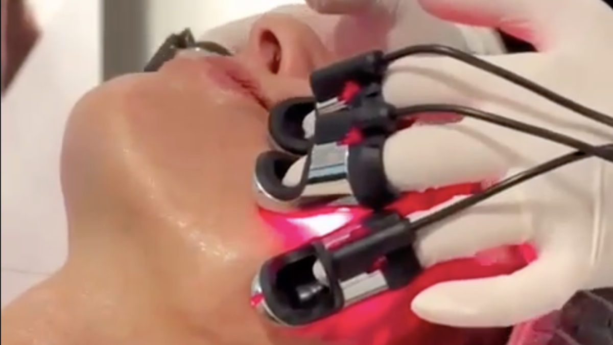 Radiofrecuencia facial y corporal con guantes