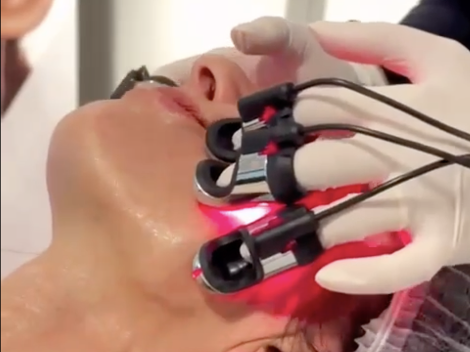 Radiofrecuencia facial y corporal con guantes